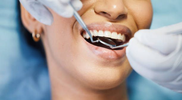 Best Emergency Root Canal Treatment in Lake Linden, MI