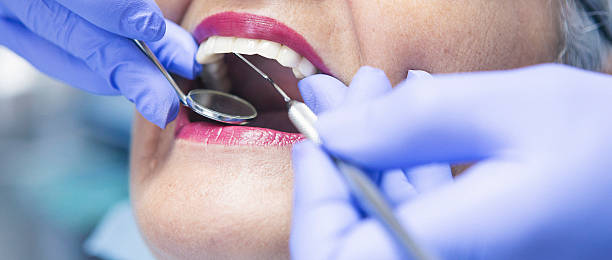 Best Emergency Dental Extractions in Lake Linden, MI